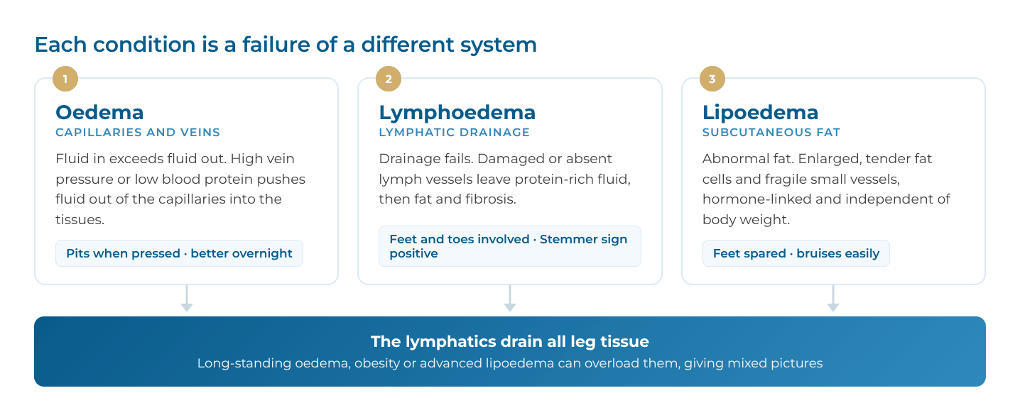 Diagram of three panels: oedema (capillaries and veins, fluid in exceeds fluid out), lymphoedema (lymphatic drainage fails) and lipoedema (abnormal subcutaneous fat), all draining to the lymphatics