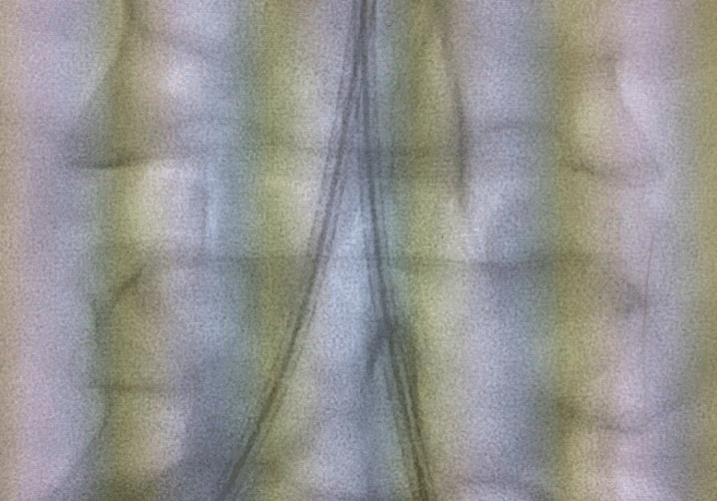 VBX as primary choice